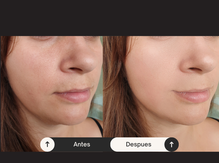 beige minimalist skincare before and after instagram post 5.webp