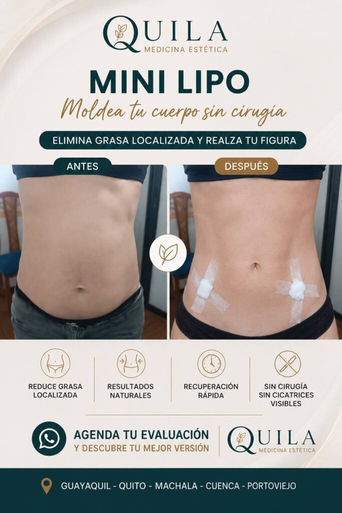 mini lipo
